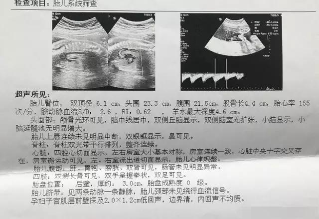 殲-11B重型戰(zhàn)斗機(jī)，卓越性能與先進(jìn)技術(shù)的完美結(jié)合，殲-11B重型戰(zhàn)斗機(jī)，卓越性能與技術(shù)的巔峰融合
