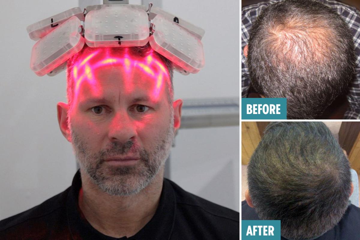 激光手術(shù)費用詳解，多少錢一次？，激光手術(shù)費用全面解析，手術(shù)費用究竟是多少？