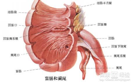 闌尾炎疼痛部位解析，闌尾炎疼痛部位詳解