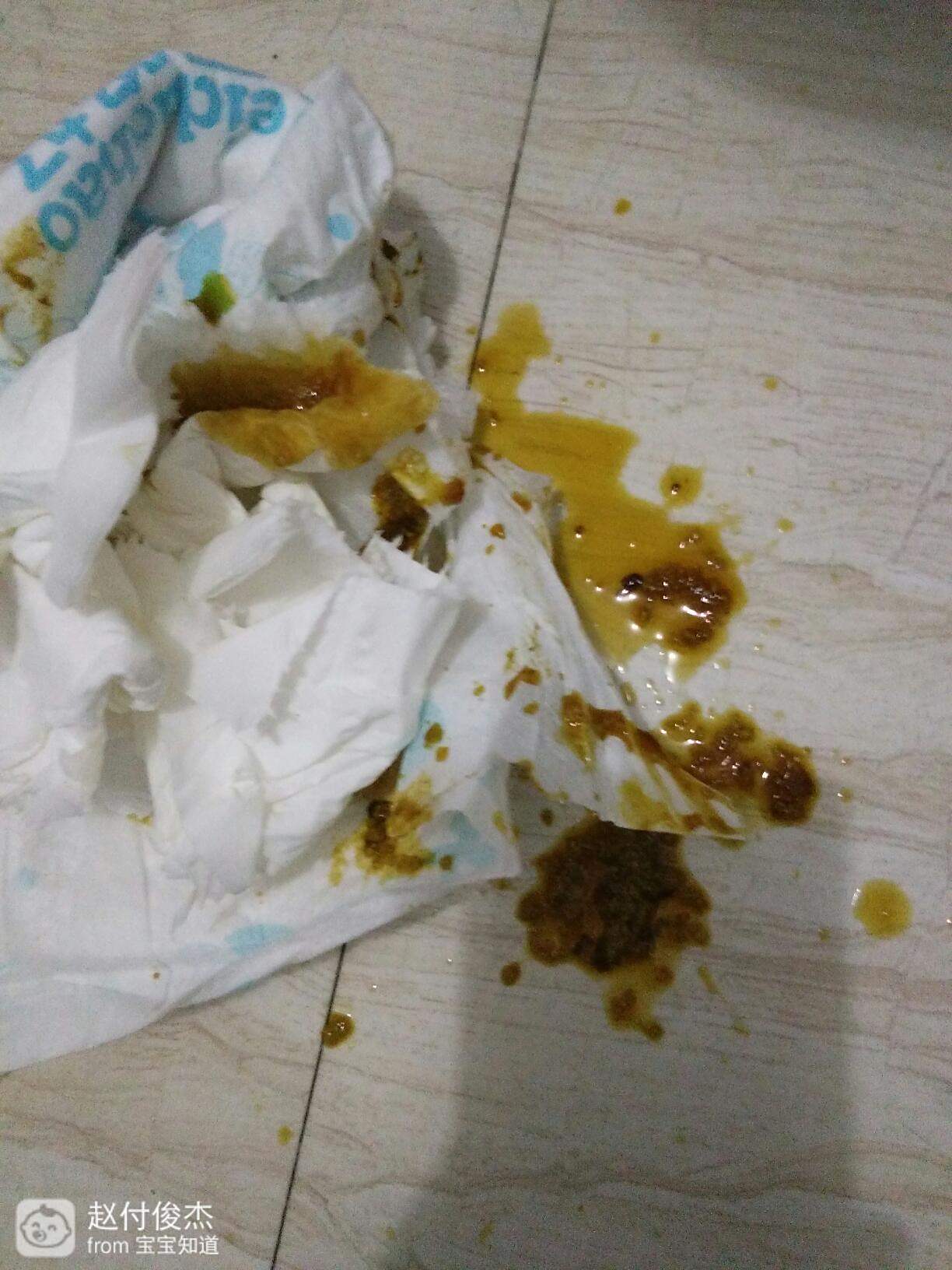 寶寶腹瀉一進(jìn)食就拉，原因、應(yīng)對(duì)措施與預(yù)防方法，寶寶腹瀉，進(jìn)食即拉的原因、應(yīng)對(duì)措施及預(yù)防方法全解析