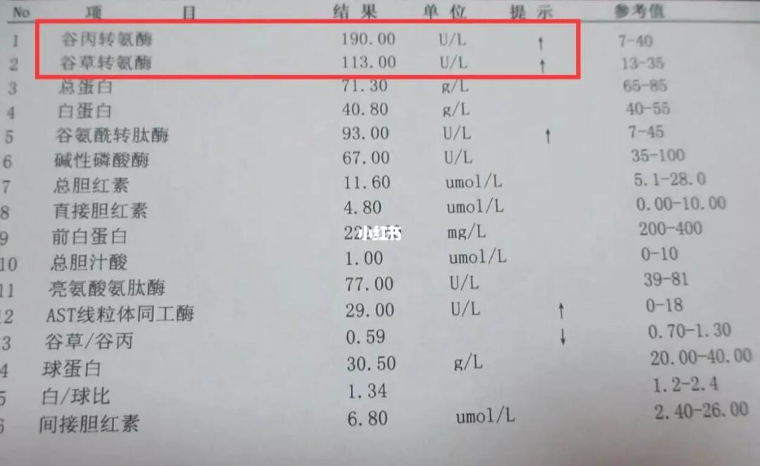 轉(zhuǎn)氨酶高多少是肝炎？解讀肝炎與轉(zhuǎn)氨酶水平的關系，解讀肝炎與轉(zhuǎn)氨酶水平關系，轉(zhuǎn)氨酶高多少可判定為肝炎？