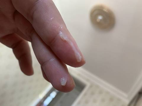 關(guān)于性行為后白帶增多的原因解析，性行為后白帶增多原因解析，揭秘背后的健康隱患