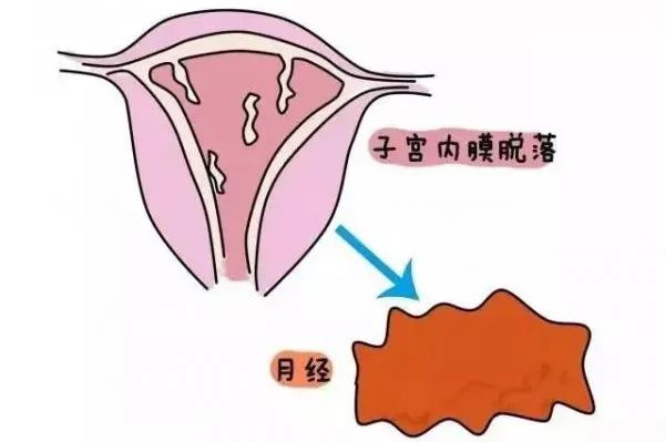 子宮內(nèi)膜增厚能自愈嗎？解析與探討，子宮內(nèi)膜增厚能否自愈？深度解析與探討