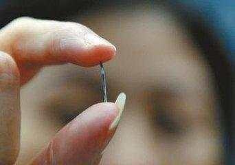 取環(huán)手術(shù)，一個(gè)人能否獨(dú)自面對？，獨(dú)自面對取環(huán)手術(shù)，挑戰(zhàn)與應(yīng)對之道