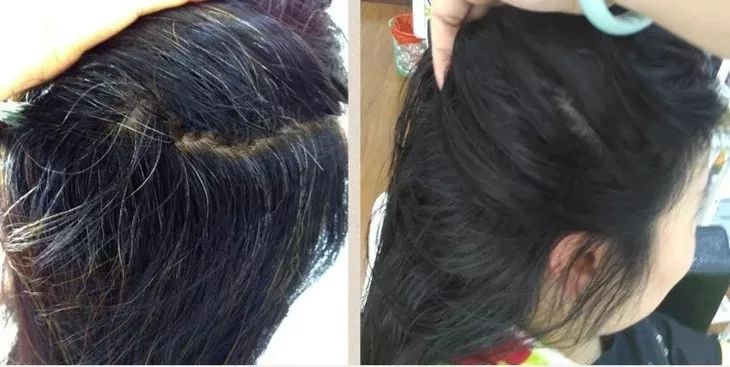 白發(fā)轉(zhuǎn)黑發(fā)，可能性與實現(xiàn)方法，白發(fā)轉(zhuǎn)黑發(fā)的可能性與實現(xiàn)方法探討