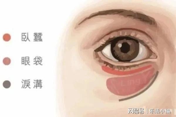 眼袋切除手術(shù)費(fèi)用詳解，價(jià)格因素與如何選擇合適的手術(shù)方案，眼袋切除手術(shù)費(fèi)用解析，了解價(jià)格因素與選擇最佳手術(shù)方案