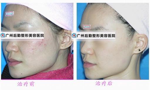 揭秘祛斑秘籍，如何有效祛斑？，揭秘祛斑秘籍，有效祛斑方法與技巧探討