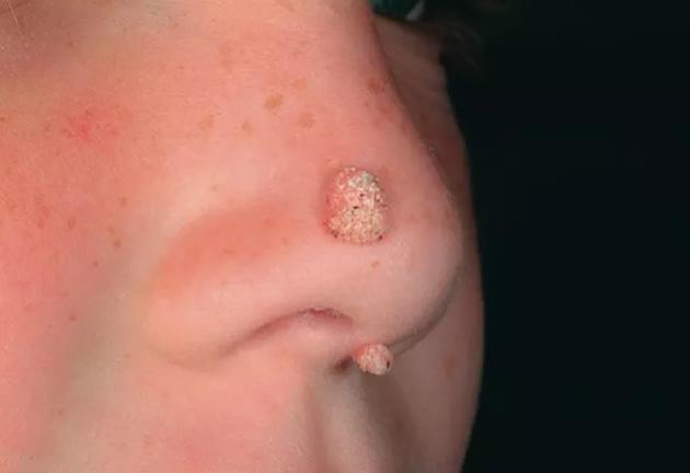 推薦 第15頁(yè)